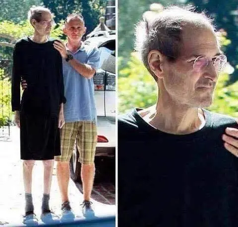 Steve Jobs' Cancer Treatment